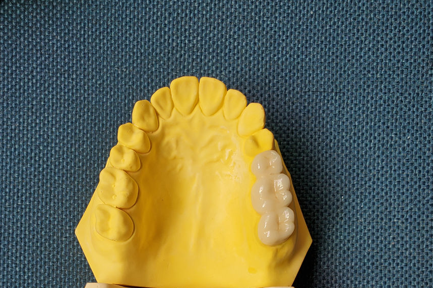 1692862975384488.png 07e9fee3fee3e33b42d1ac9d6e69971.png